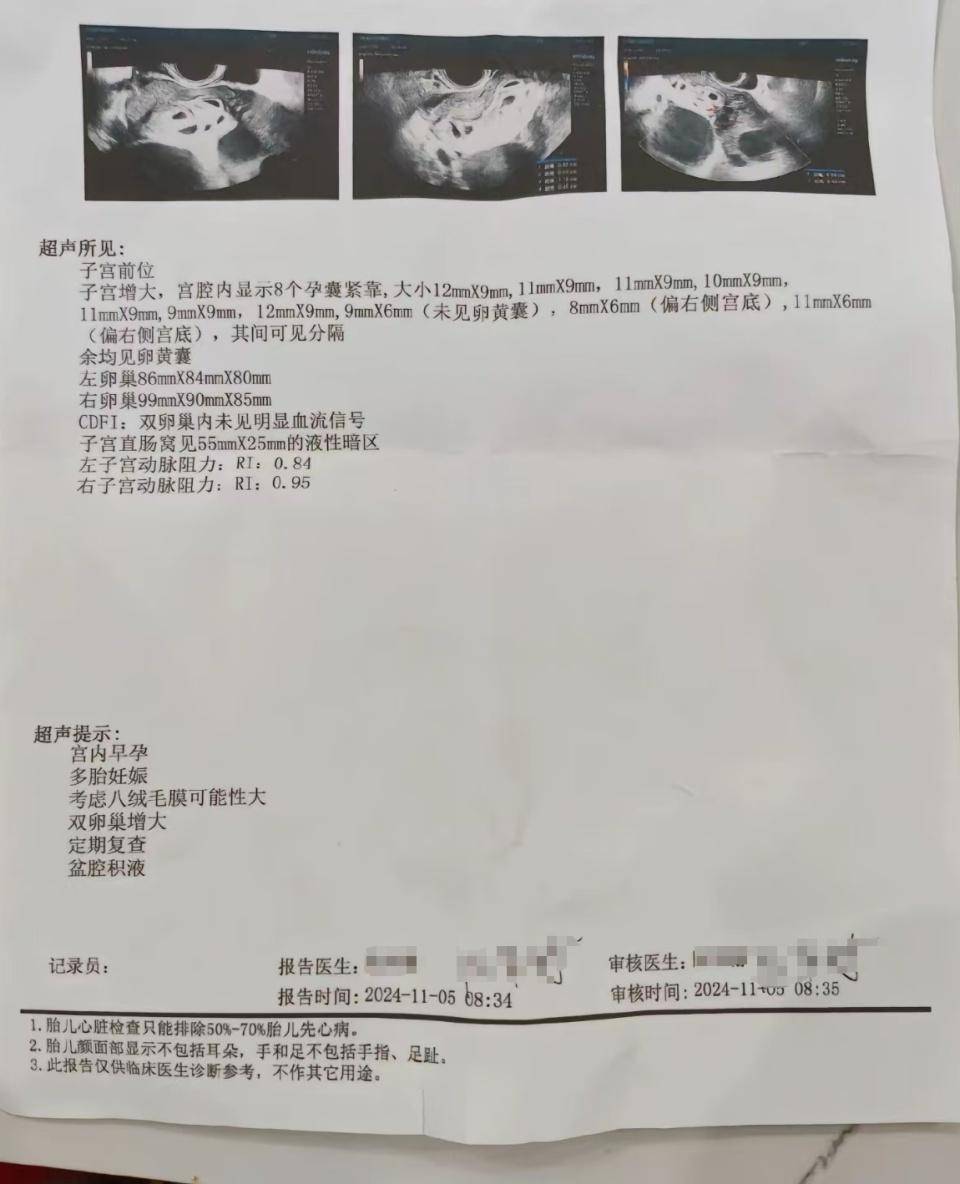 皇冠登一登二登三区别_怀上9胞胎女子今日进行减胎手术：分两次进行皇冠登一登二登三区别，第一次减去四个胚胎，第二次减去三个