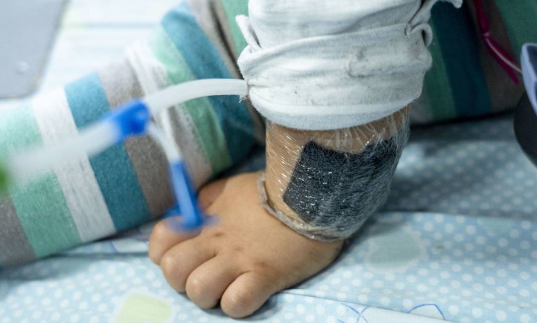 皇冠信用網账号注册_可瞬间产生近100℃高温皇冠信用網账号注册！合肥医生发出提醒