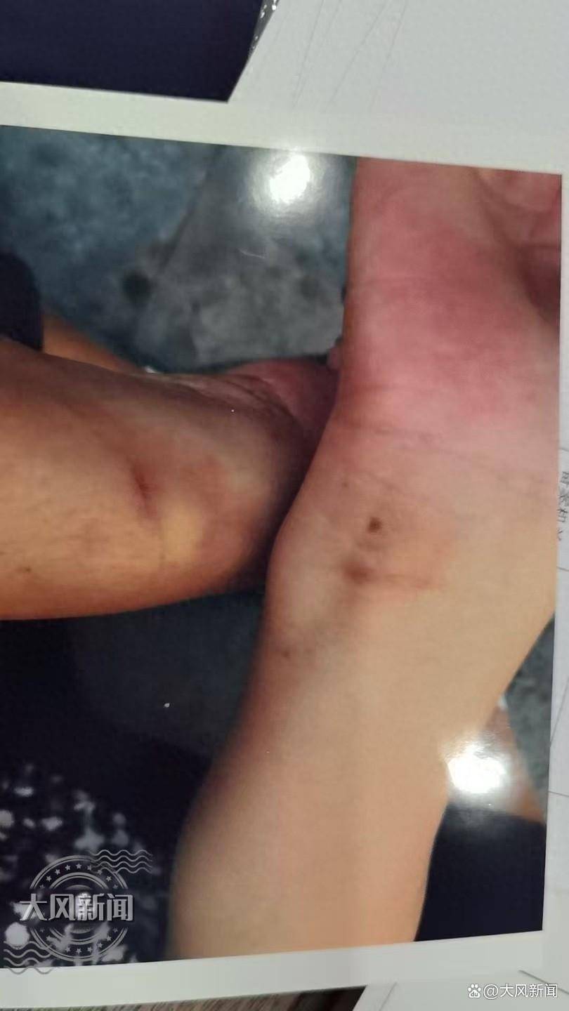 皇冠信用網代理登1_36岁儿子在浴场宿舍突身亡皇冠信用網代理登1，母亲为讨说法遭背铐受伤？当地警方否认执法存在问题