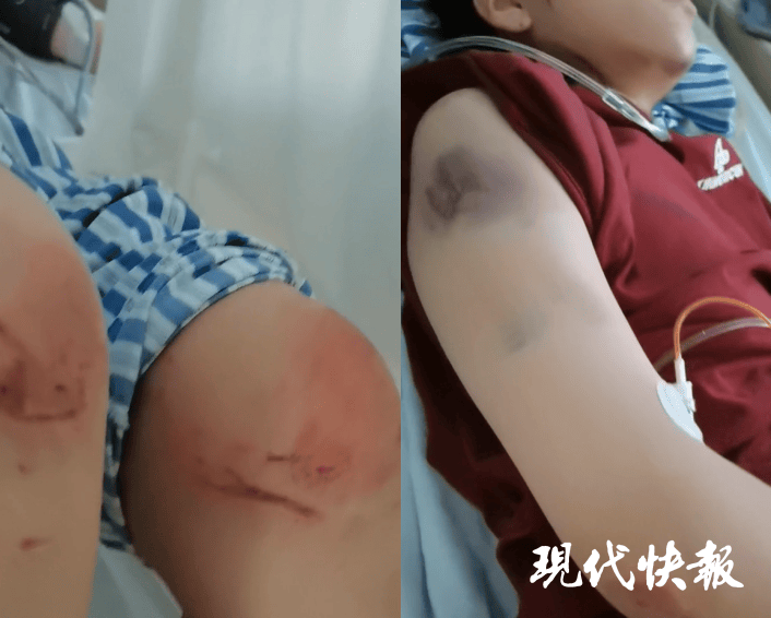 皇冠信用盘在哪里开通_石家庄被家暴女子驾车逃跑致丈夫身亡皇冠信用盘在哪里开通，一审以故意杀人罪获刑11年