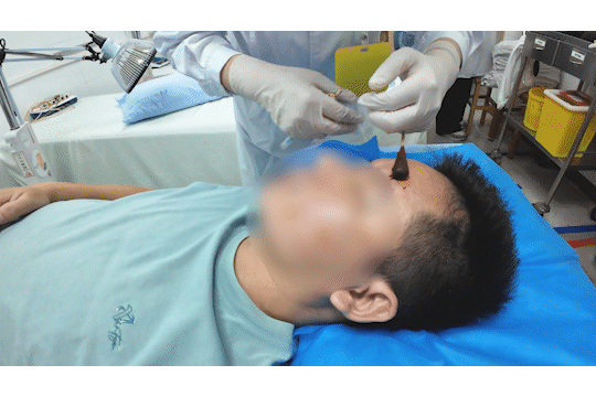 皇冠信用网登2代理_醒来“天塌了”皇冠信用网登2代理！深圳一女子眼睛闭不上、嘴巴漏水！这些错误很多人会犯