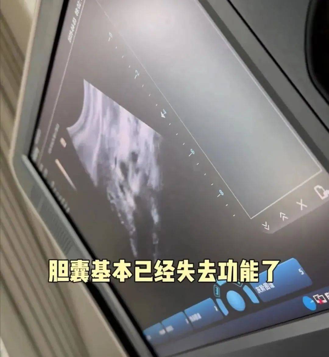 澳大利亚(女) v 荷兰(女)_36岁知名女演员确诊澳大利亚(女) v 荷兰(女)！“已基本失去功能”