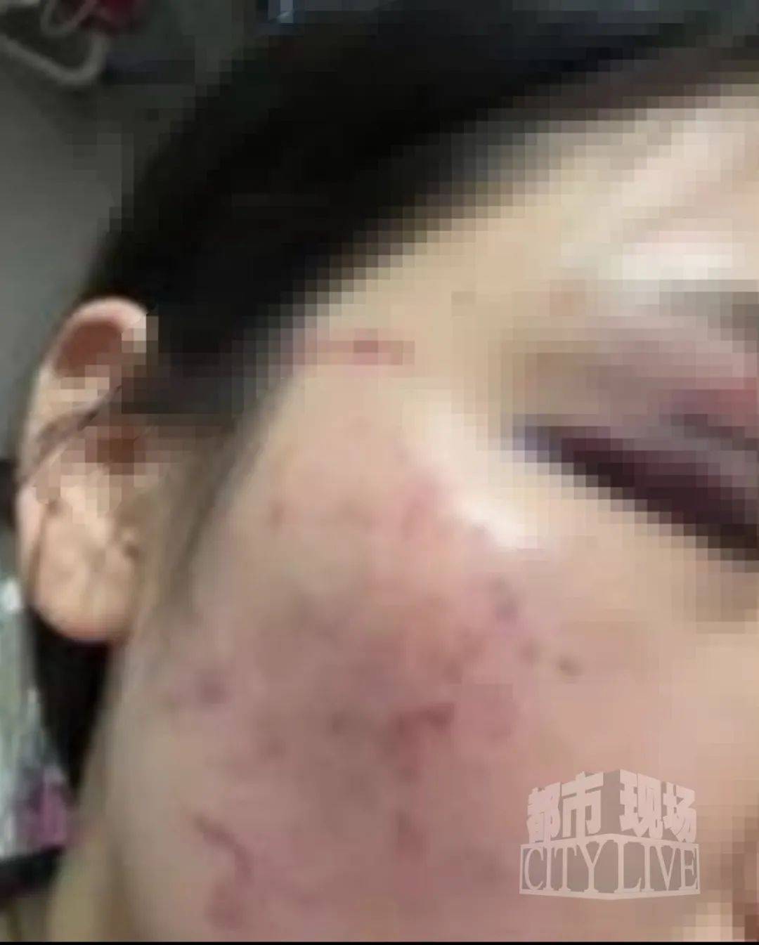 皇冠信用盘如何注册_湖南衡阳29岁女子疑被男友施暴后从25楼跳下身亡 男友徐某此前还刺激说：“你放心皇冠信用盘如何注册，她不会去死的”