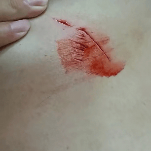 保加利亚U21 vs 直布罗陀U21_罕见！大连钓友钓到一条20斤大鲅鱼保加利亚U21 vs 直布罗陀U21，反被鲅鱼利齿咬伤胸部