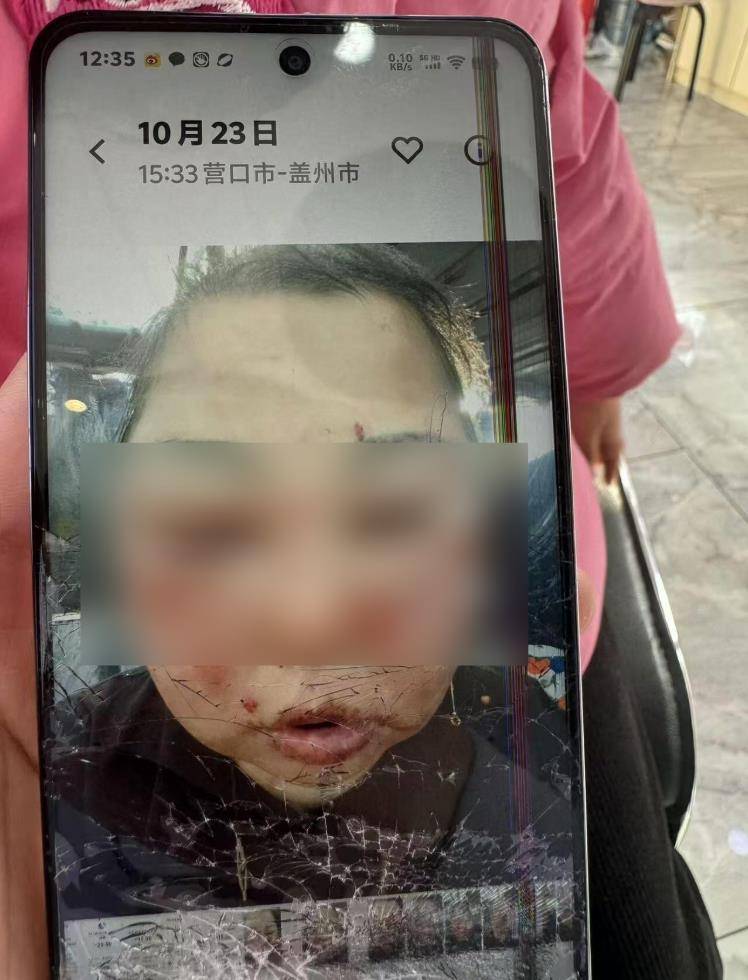 皇冠信用網出租_被前夫打进ICU的女子不幸身亡皇冠信用網出租，大女儿称正送母亲去殡仪馆，今后安排暂未考虑，希望严惩凶手