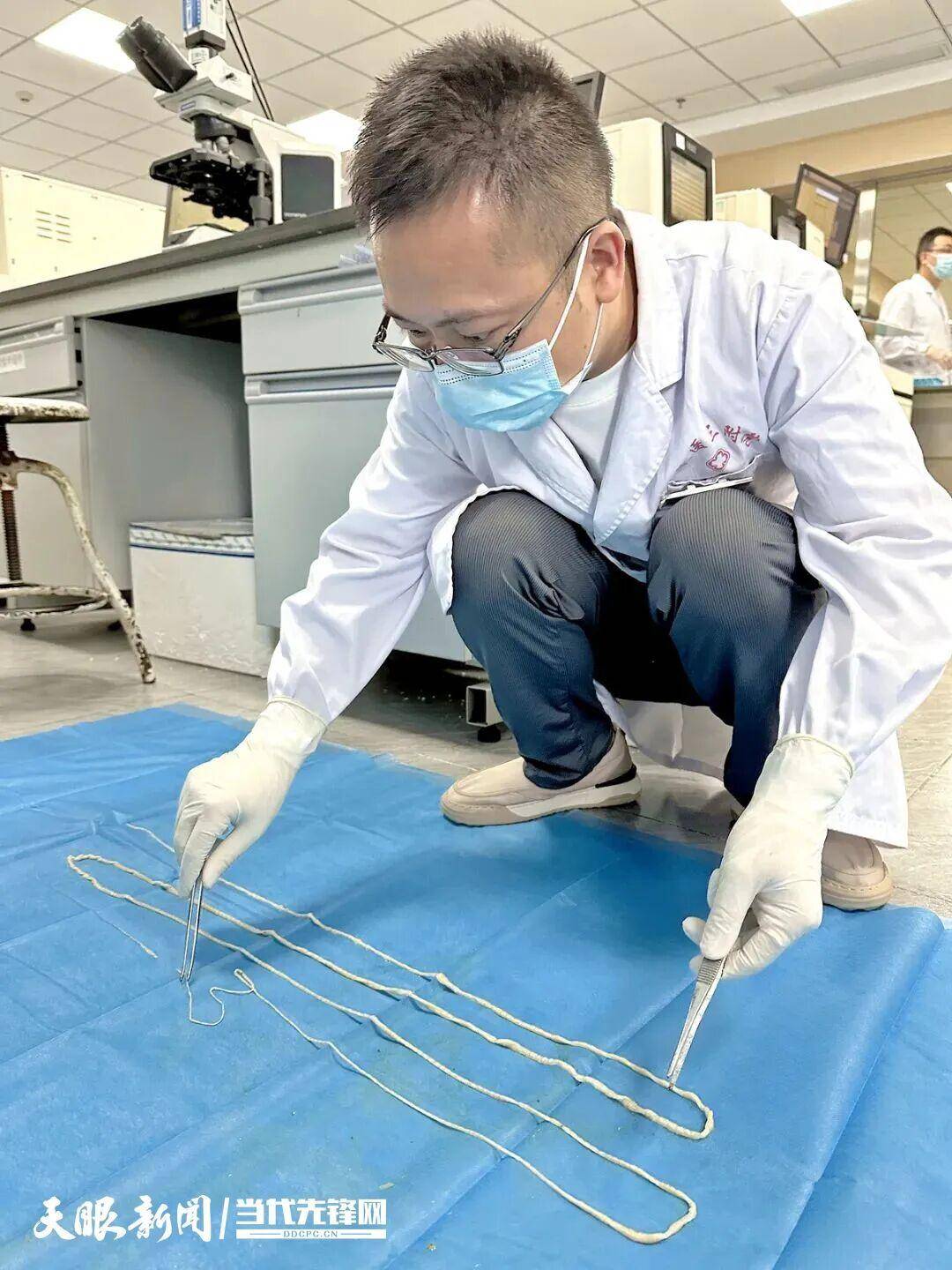 土耳其甲组联赛_最长4米！贵州一男子连续7个月排出“面条状异物”土耳其甲组联赛，医生：很可能和吃这种生食有关