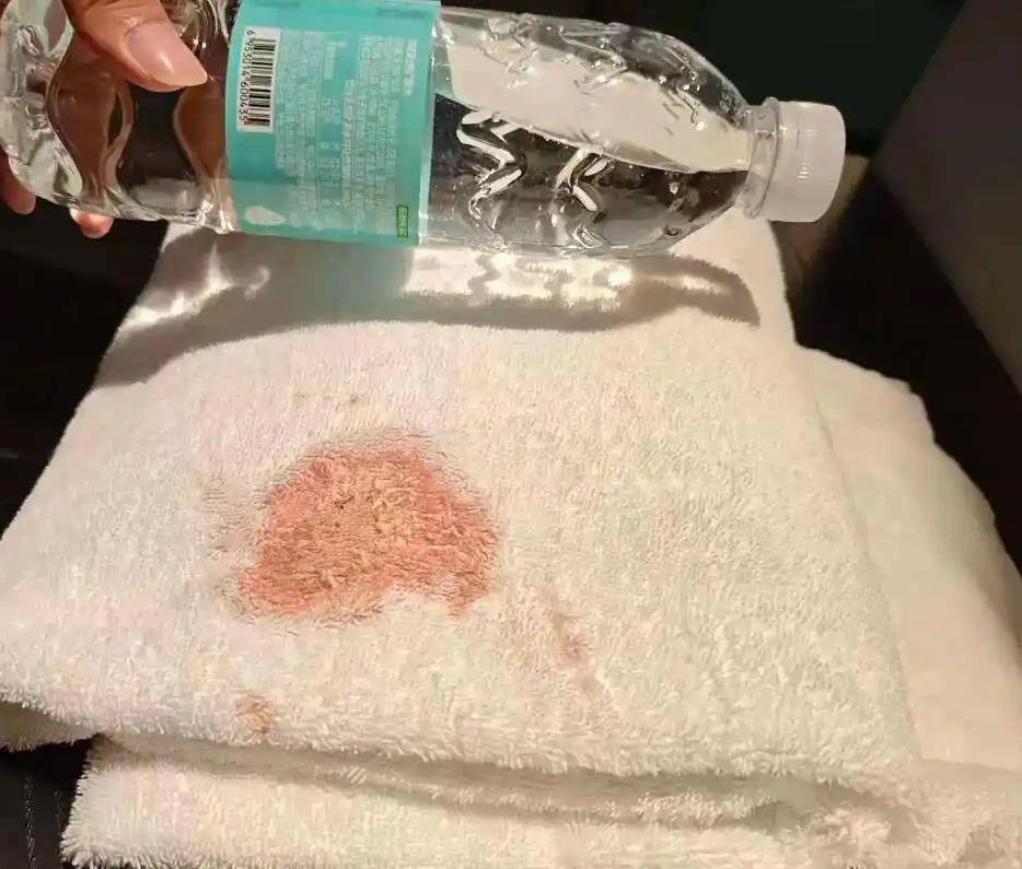 皇冠信用網如何申请_希岸酒店浴巾上出现大片血迹皇冠信用網如何申请，到底是谁的责任？