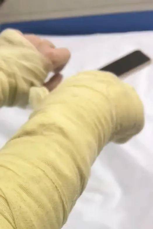 怎么开通皇冠信用網口_女主播称遭伪装快递包裹炸伤怎么开通皇冠信用網口，湖南警方通报