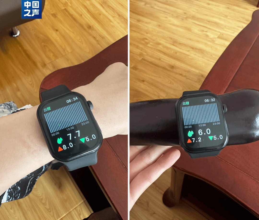 阿森纳vs利兹联_父母花84元网购“神奇手表”阿森纳vs利兹联，儿子发现能测万物：猫咪血糖5.9，吸尘器血糖7.4，父母：下次不买了